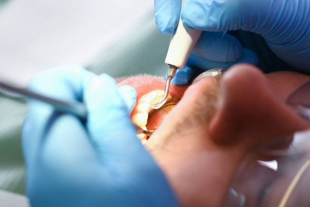 Best Dentist Open on Weekends  in Towson, MD